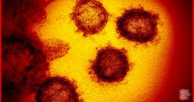 Coronavirus: scoperto il farmaco che blocca l’infezione SARS-CoV-2 coronavirus farmaco